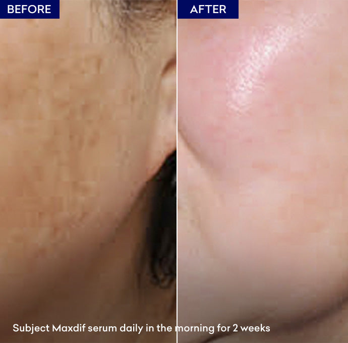 Maxdif Brightening Serum