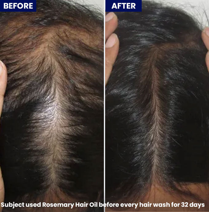 Anagrow Rosemary Hair Oil
